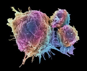 breast-cancer-cell-destroyed